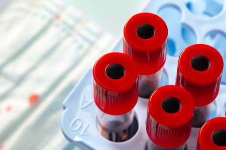 Stained medical protective mask with test tubes. Virus diagnostic and treatment analysis concept.の写真素材