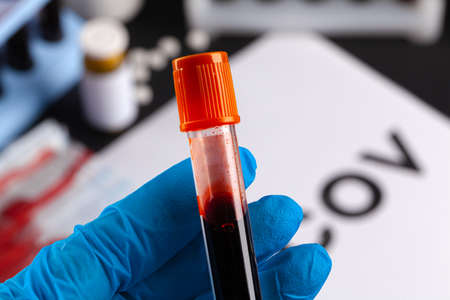 Coronavirus outbreak concept.Coronavirus diagnosis, laboratory testingの写真素材