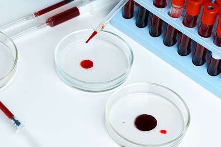 Glass dropper and Petri dish on laboratory tableの写真素材