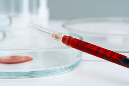 Glass dropper and Petri dish on laboratory table