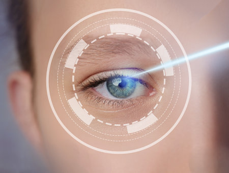 Advanced laser technology enhances vision through precision treatment in a clinical settingの写真素材