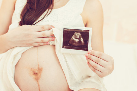 Expectant mother holding ultrasound image on her pregnant belly during maternity preparation