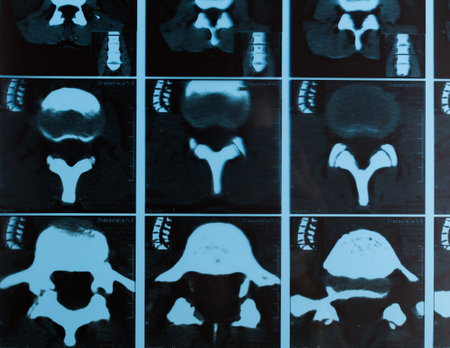 Understanding spinal health through detailed X-ray images for diagnosis and treatment
