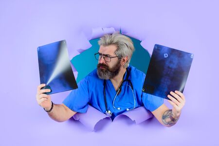 Through paper. Doctor with x-ray. X-ray. Medicine. Bones. X-ray bones. X ray photo of spine. Radiograph. Man with xray photo of spine. Doctorの写真素材