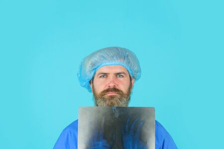 X-ray. Bones. X-ray bones. Medicine. Doctor with x-ray photo of hand. X ray photo of hands. Radiograph. Man with xray photo of hands. Doctorの写真素材