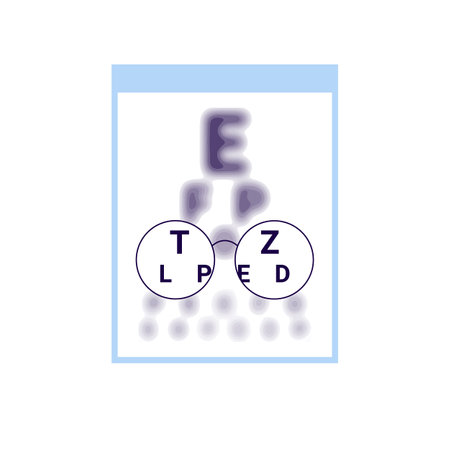 Test table with clarity vision eye in glasses and blur outside vision, chart check eyevision. Visual impairment, myopia correction. Vector illustrationのイラスト素材