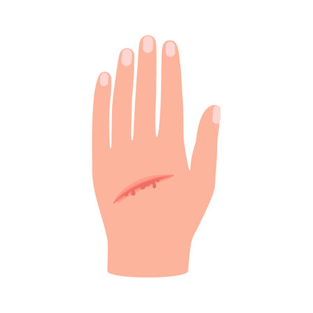 Wound of hand human skin, scratch. Cut injury skin, bleeding cut. Vectorのイラスト素材