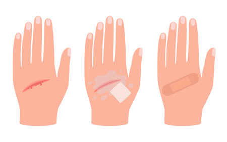 Wound of hand human skin, scratch. First aid for cut injury skin, bleeding cut. Clean and disinfection wound, patch for safe health. Vectorのイラスト素材