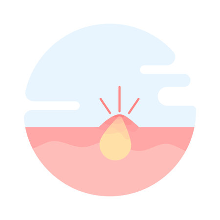 Acne and skin irritation concept showing clogged hair follicles, sebum buildup, swelling, pus, and symptoms related to allergies or eczema. flat design illustration on background.のイラスト素材