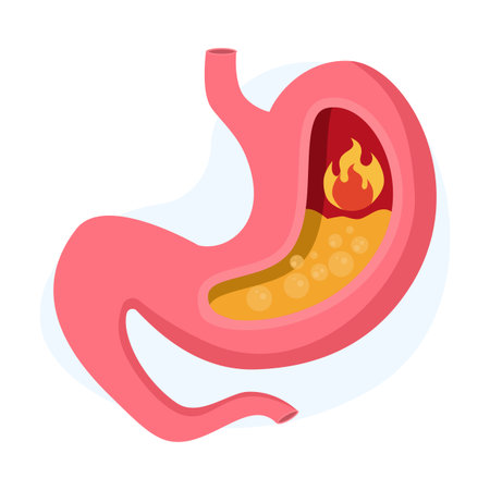 Stomach acid rising and heartburn concept, showing a stomach organ with flames, symbolizing GERD, digestive discomfort, and health issues in a minimalist graphic style.のイラスト素材
