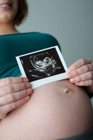 Pregnant woman holding ultrasound Photoの写真素材