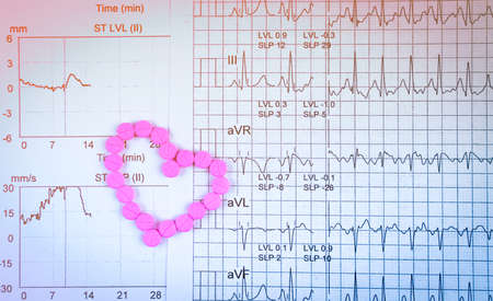 EKG or ECG (Electrocardiogram) graph report paper. EST ( Exercise Stress Test ) result and pink heart shape made from pills. Package promotion for heart check up in senior or elderly people concept.の写真素材