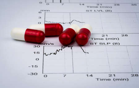 EKG or ECG (Electrocardiogram) graph report paper. EST ( Exercise Stress Test ) result and red-white capsule pills. Package promotion for heart check up in senior or elderly people concept.の写真素材
