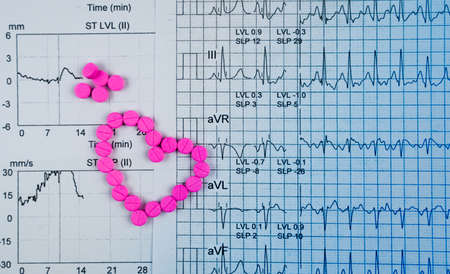 EKG or ECG (Electrocardiogram) graph report paper. EST ( Exercise Stress Test ) result and pink heart shape made from pills. Package promotion for heart check up in senior or elderly people concept.の写真素材