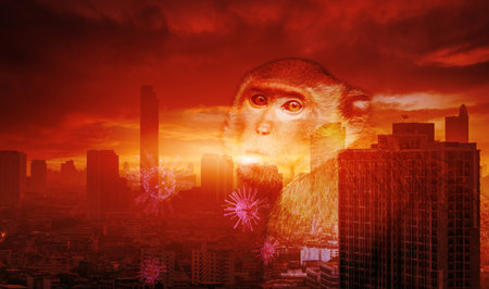 Mpox outbreak caused by monkeypox virus. Smallpox vaccine, public health efforts, and strategies for prevention, management, and control in urban settings with focus on disease spread and containment.の写真素材