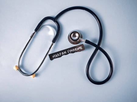 Stethoscope Near Piece of Paper with "Marfan Syndrome" Text on Blue Background: A Concept for Genetic Connective Tissue Disorder Diagnosis and Awarenessの写真素材