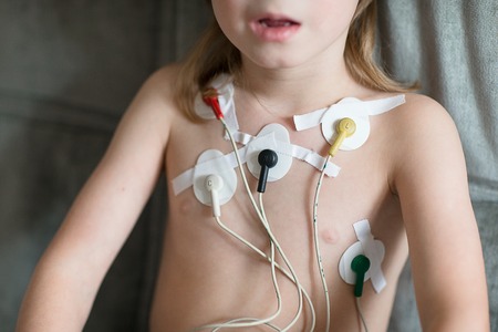 Heart cardiogram or monitoring of cardiac performance using Holter. Child check the heart.の写真素材