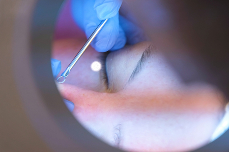 Facial cleansing at the beautician. Squeezing pimples on the nose with a needle and magnifier.の写真素材