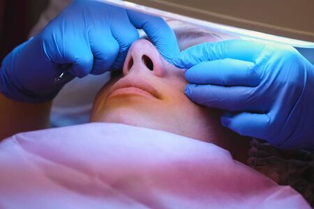 Facial cleansing at the beautician. Squeezing pimples on the nose with a needle and magnifier....
