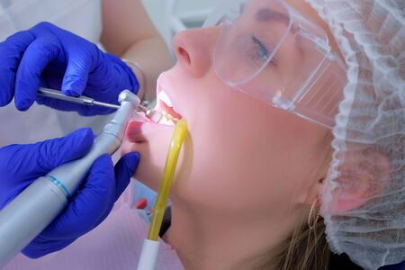 Dental hygienist makes ultrasonic cleaning teeth to woman in dentistry. Dentist cleaning brushing womans teeth use drill, closeup view. Ultrasound teeth procedure in stomatology clinic. Oral hygiene.の写真素材