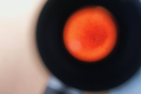 Surgeon dermatologist oncologist examines mole uses dermatoscope, closeup view through magnifier. Diagnosing nevus or birthmark on cancer risk prediction on skin. Control of melanoma on patient body.の写真素材