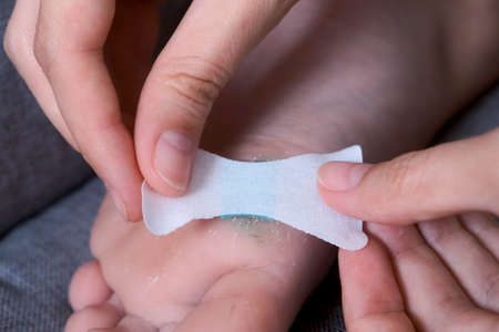 Mother is sticking plaster on wound on childs foot with antibacterial powder, closeup view....