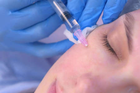 Cosmetologist doctor is making multiple injections biorevitalization in woman face skin under eye,...