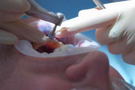 Stomatologist is cleaning mans teeth using electric toothbrush in dentistry. Dentist brushing...