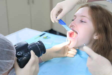 Dentist orthodontist photographing using camera girls teeth on lower jaw showing it in mirror....