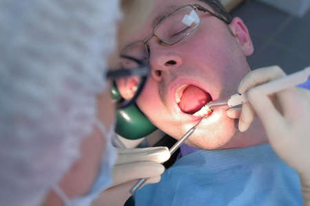 Dentist examining gums of patient with probe and needle using method of computer diagnostics. Measuring depth of periodontal pockets of gums in stomatology clinic, dentistry. Portrait of man.の写真素材