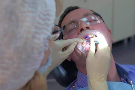 Dentist is applying blue gel on mans teeth to find dental tartar and caries. Hygiene care for oral cavity, prophylactic cleaning of teeth in dentistry, stomatology clinic. Saliva ejector in mouth.の写真素材