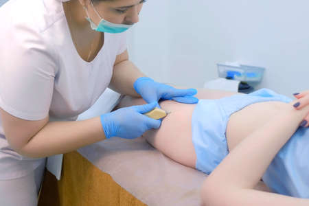 Doctor is making injection of carbon dioxide on patients hip, leg on carboxytherapy. Doctor woman using special apparatus. Treatment and remove of skin tags and stretches.の写真素材