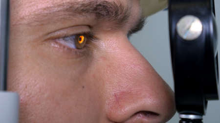 Eye test vision chartの写真素材