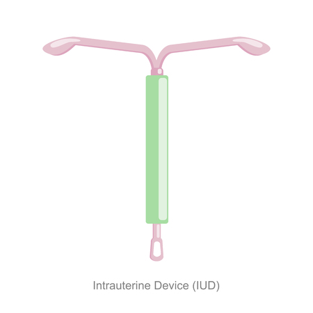 Intrauterine Device IUDのイラスト素材