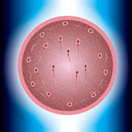 Fertilization process design, sperm and ovum combination, many sperm scramble ovum.のイラスト素材