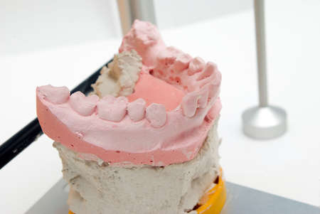 dental instrument.teeth orthopedics and surgery.の写真素材