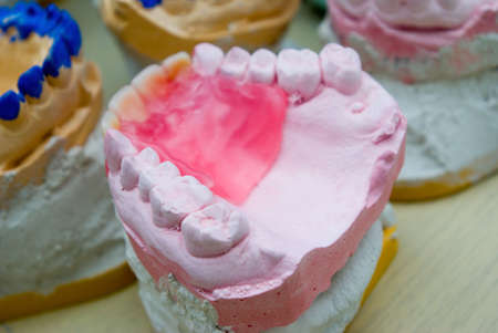 teeth mold and prosthetic devices. cabinet to stomatologiesの写真素材