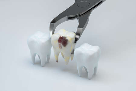 The sick tooth being pulled out, 3d rendering. Computer digital drawing.の写真素材