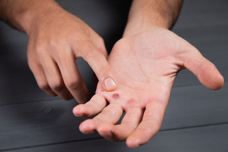 a man shows a callus on a gray backgroundの写真素材