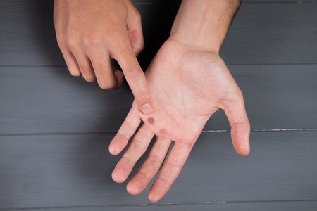 a man shows a callus on a gray backgroundの写真素材