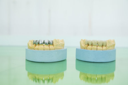 jaw mock-up on the dentist's tableの写真素材