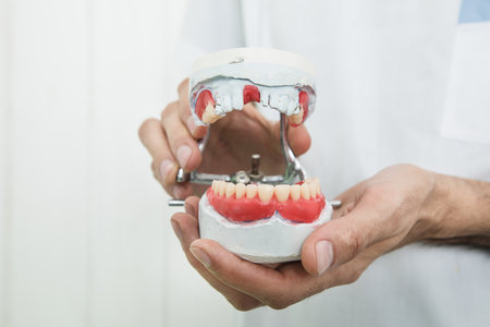 the dentist holds a mock jaw in his hand