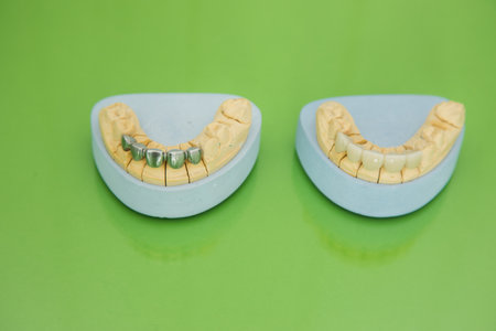 jaw mock-up on the dentist's tableの写真素材