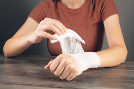 young woman bandages her handの写真素材
