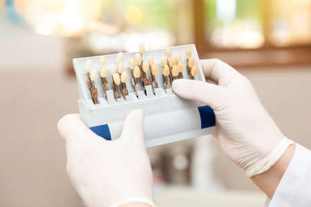 Doctor dentist woman holding tooth shade guide at clinic