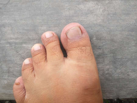 Close up of foot on wood table background with copy space.の写真素材