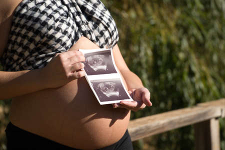 Young pregnant woman showing the ultrasound of her baby on her belly in an outdoor park. Concept pregnancy, maternity, baby, newborns.の写真素材