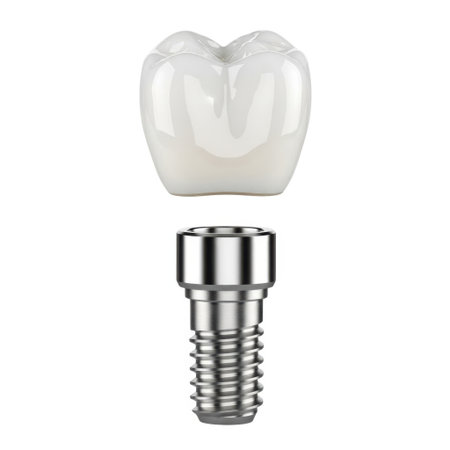 A detailed dental implant and a translucent tooth crown are displayed separately against a clean white background.の素材