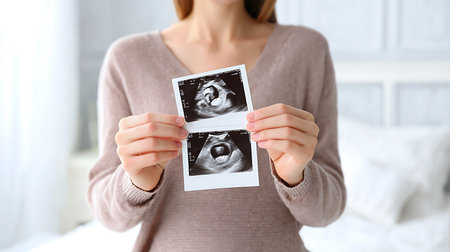 Woman holding ultrasound pictures of her unborn baby