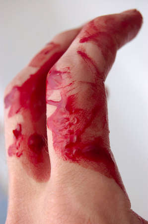 Fingers & bloodの写真素材